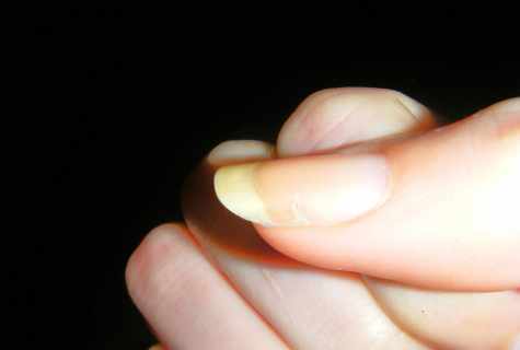 How to repair the broken nail